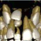 3D-Aufnahme von Zahnanlagen
